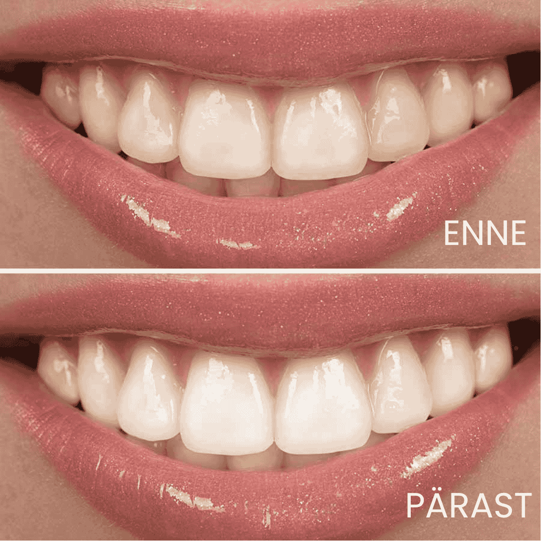 Lumine täisautomaatne nutihari